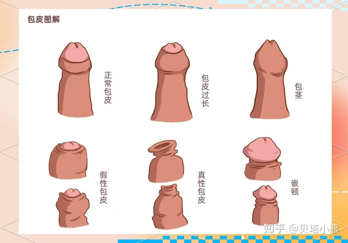 割包皮真的能让时间更持久、更爽,鸡鸡变长吗